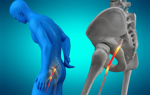 Find Relief for Chronic Back Pain: Sciatica Specialists Near Me