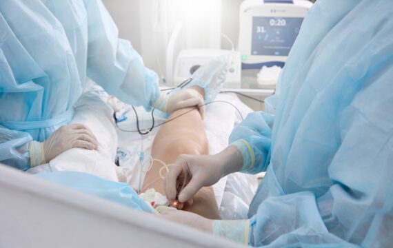 What Happens After Vein Ablation?