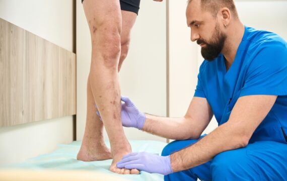 Get Expert Help for Your Veins: Find a Doctor Near You