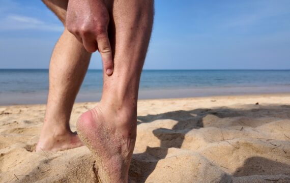 Venous Insufficiency Symptoms: Recognizing the Signs