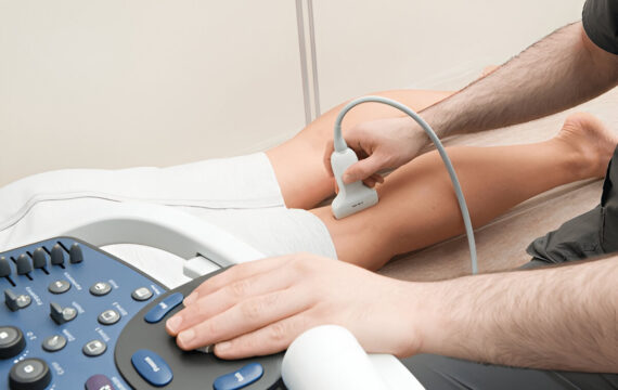 Find the Best Relief for Varicose & Spider Veins in New Jersey